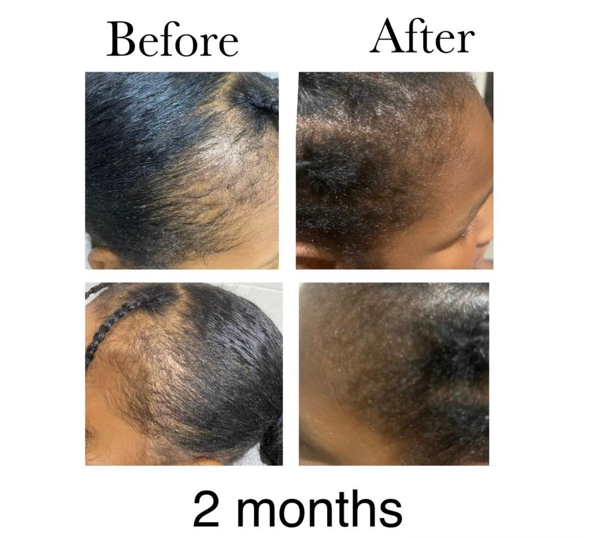 ms beez beauty hair growth oil before and after