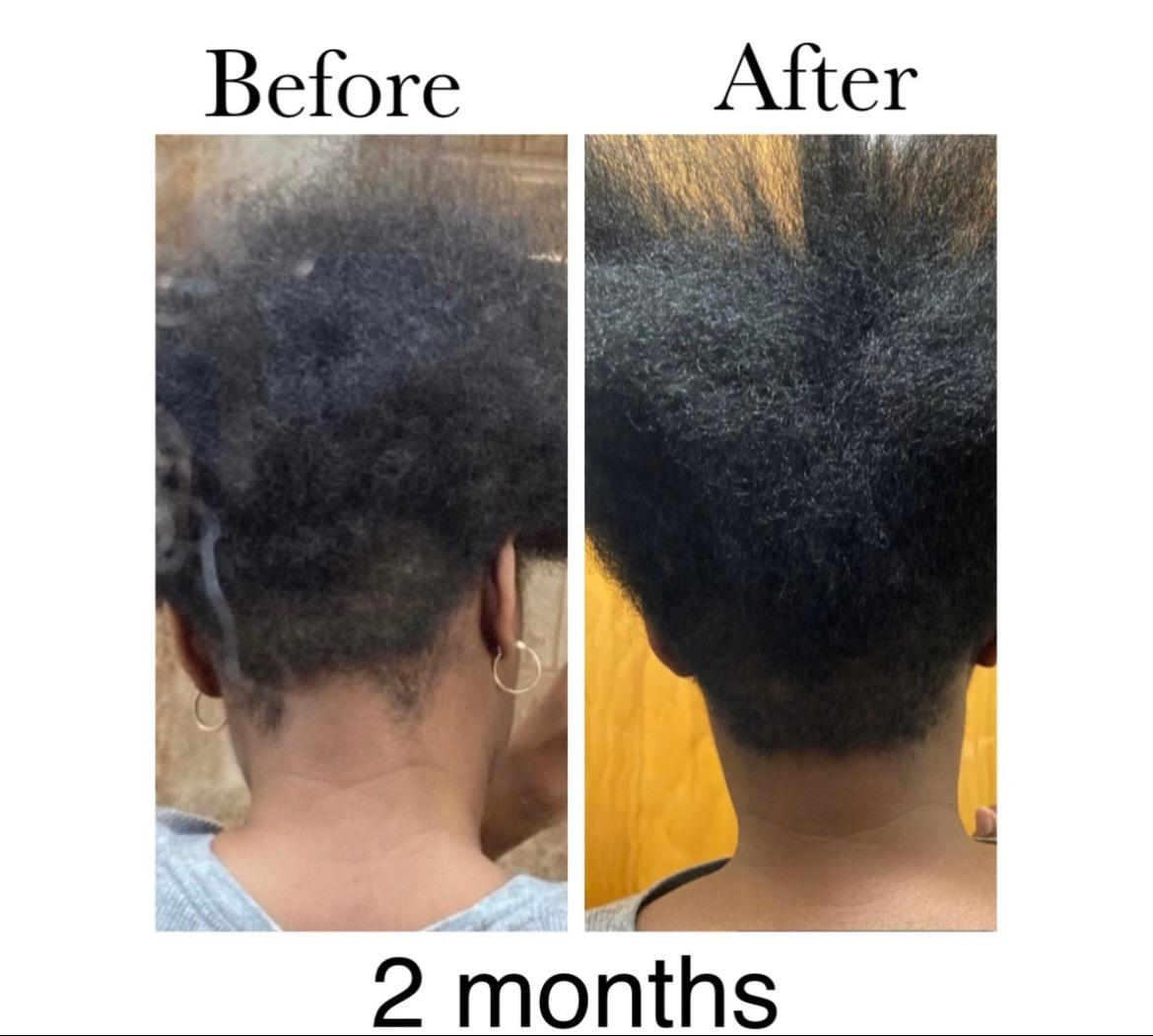 Ms Bee'z Beauty hair growth oil before and after results