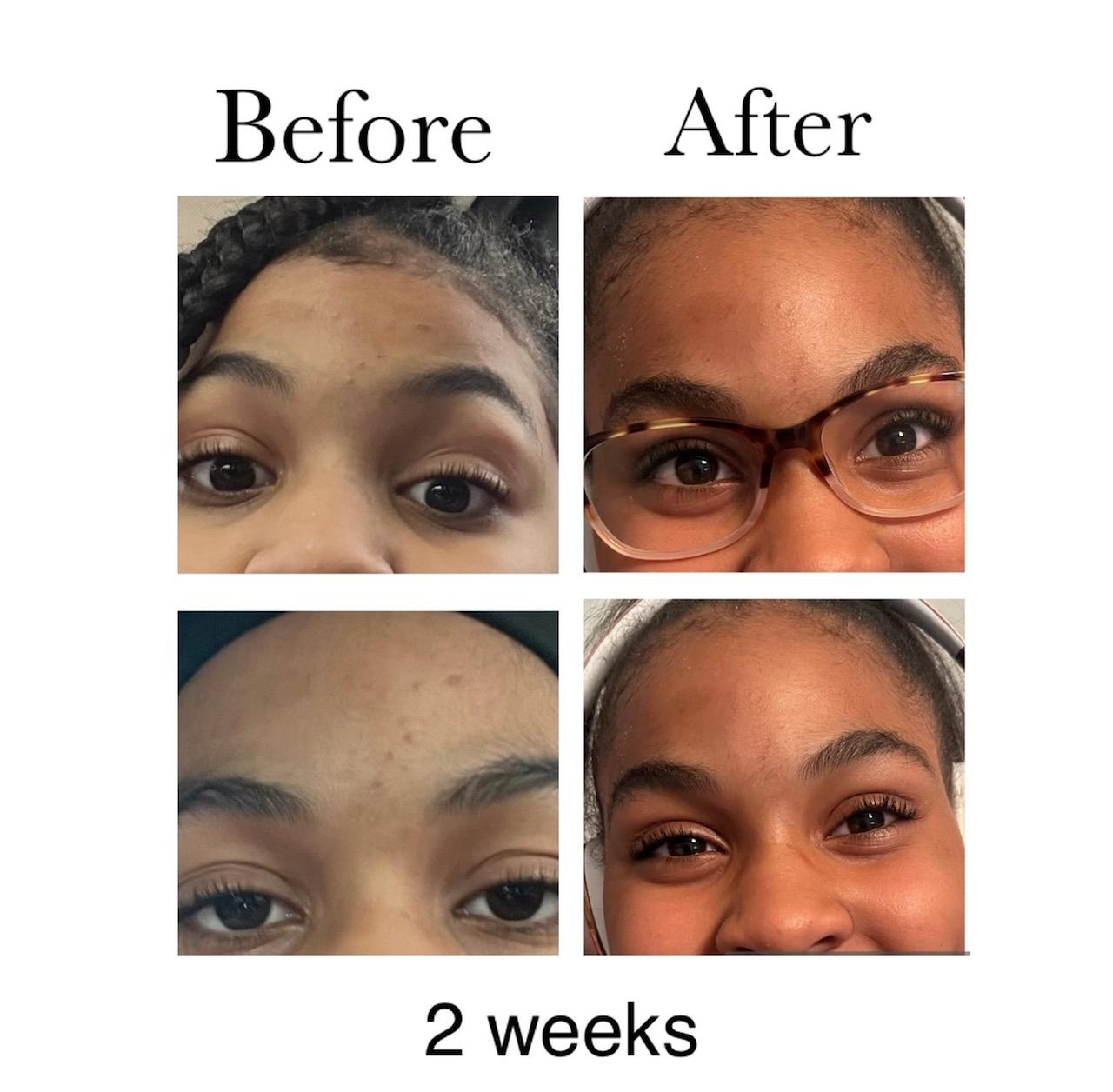 ms beez beauty skin oil before and after