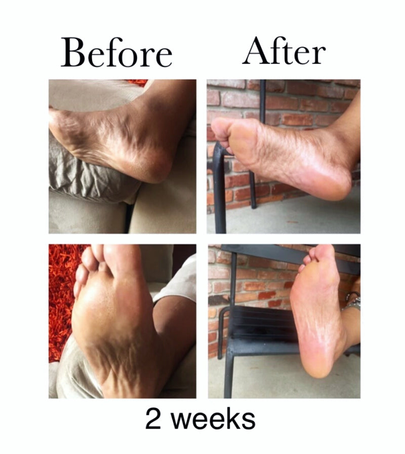 Ms Bee'z Beauty skin oil before and after results on dry feet